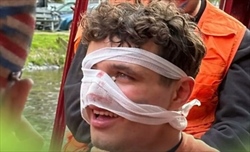 Norris infortunato ad Amsterdam, rischio forfait a Miami? Tutti i dettagli - Norris infortunato ad Amsterdam, rischio forfait a Miami? Tutti i dettagli